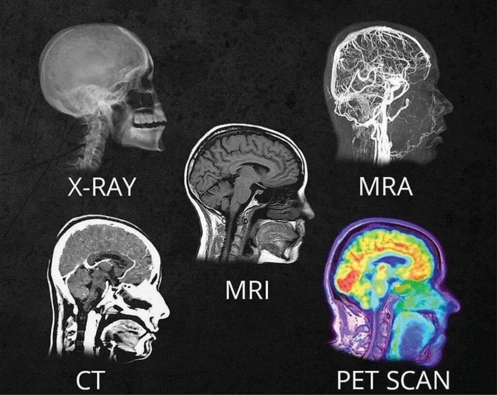 brain image